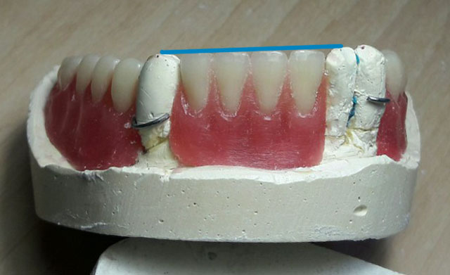 Нижній_фронт2