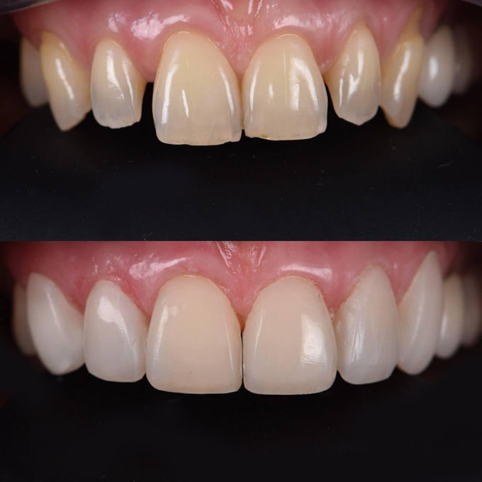 10Мокап