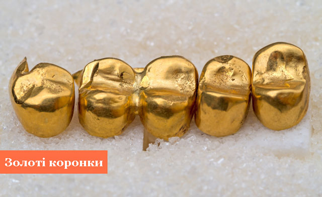 Золото_3