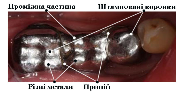 Ортопедія_9б2