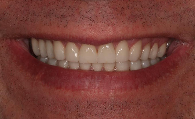 Тотальна реабілітація пацієнта_17